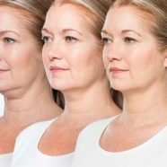 kybella dermatologist jupiter fl