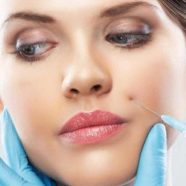 dermal-fillers