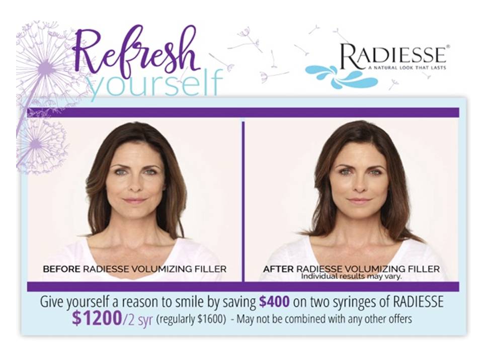 Radiesse Specials jupiter fl