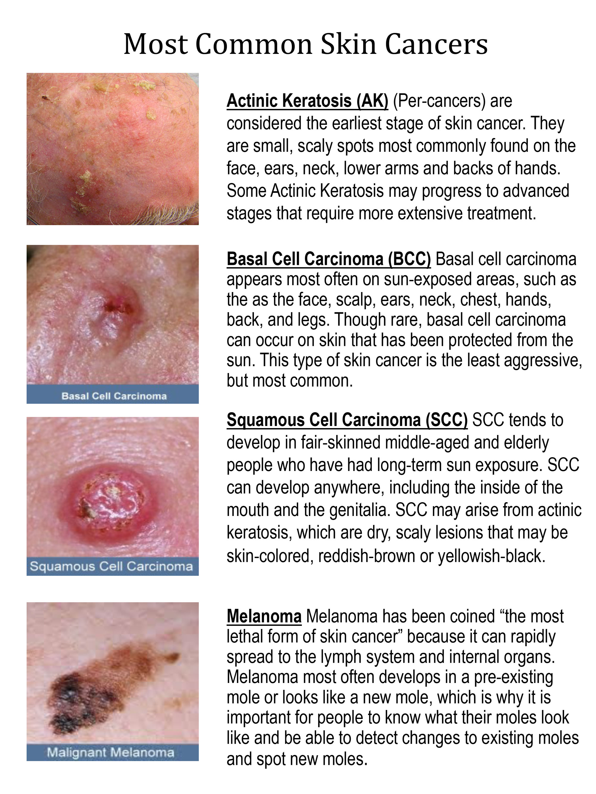 Skin Cancer Types Pics