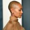 jada-pinkett-smith-alopecia-struggle