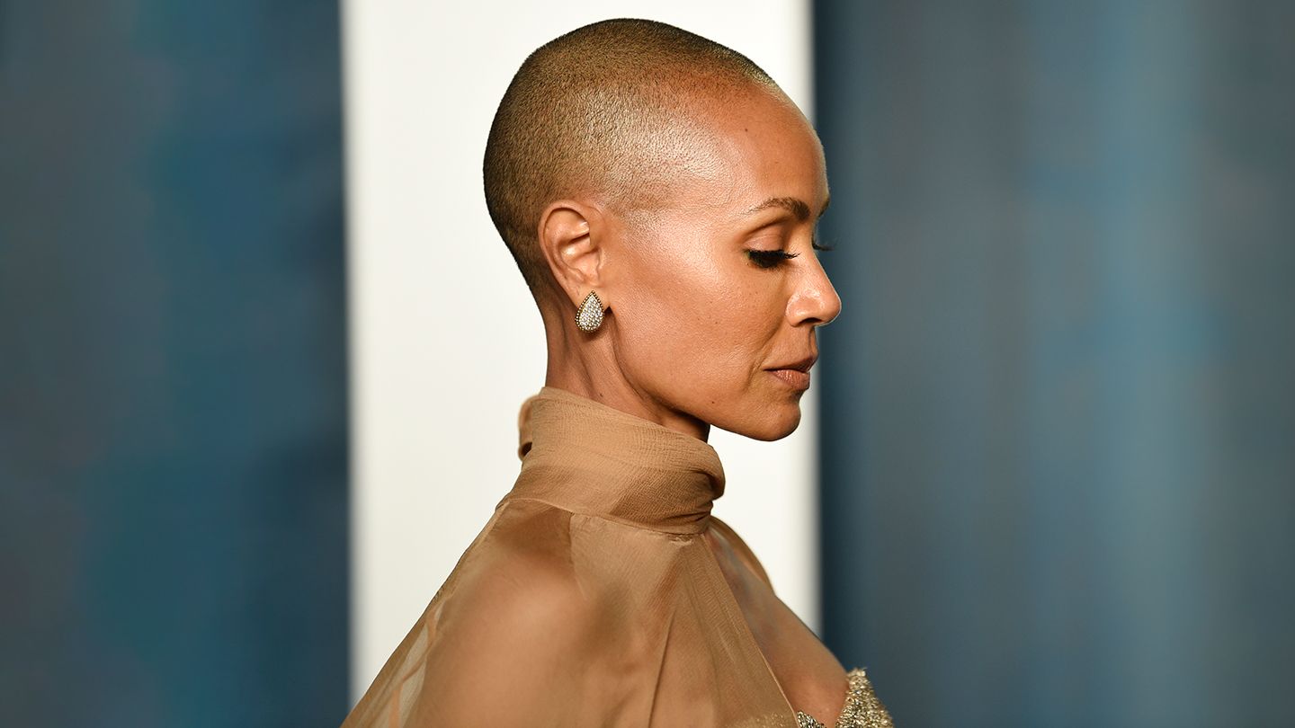 jada-pinkett-smith-alopecia-struggle