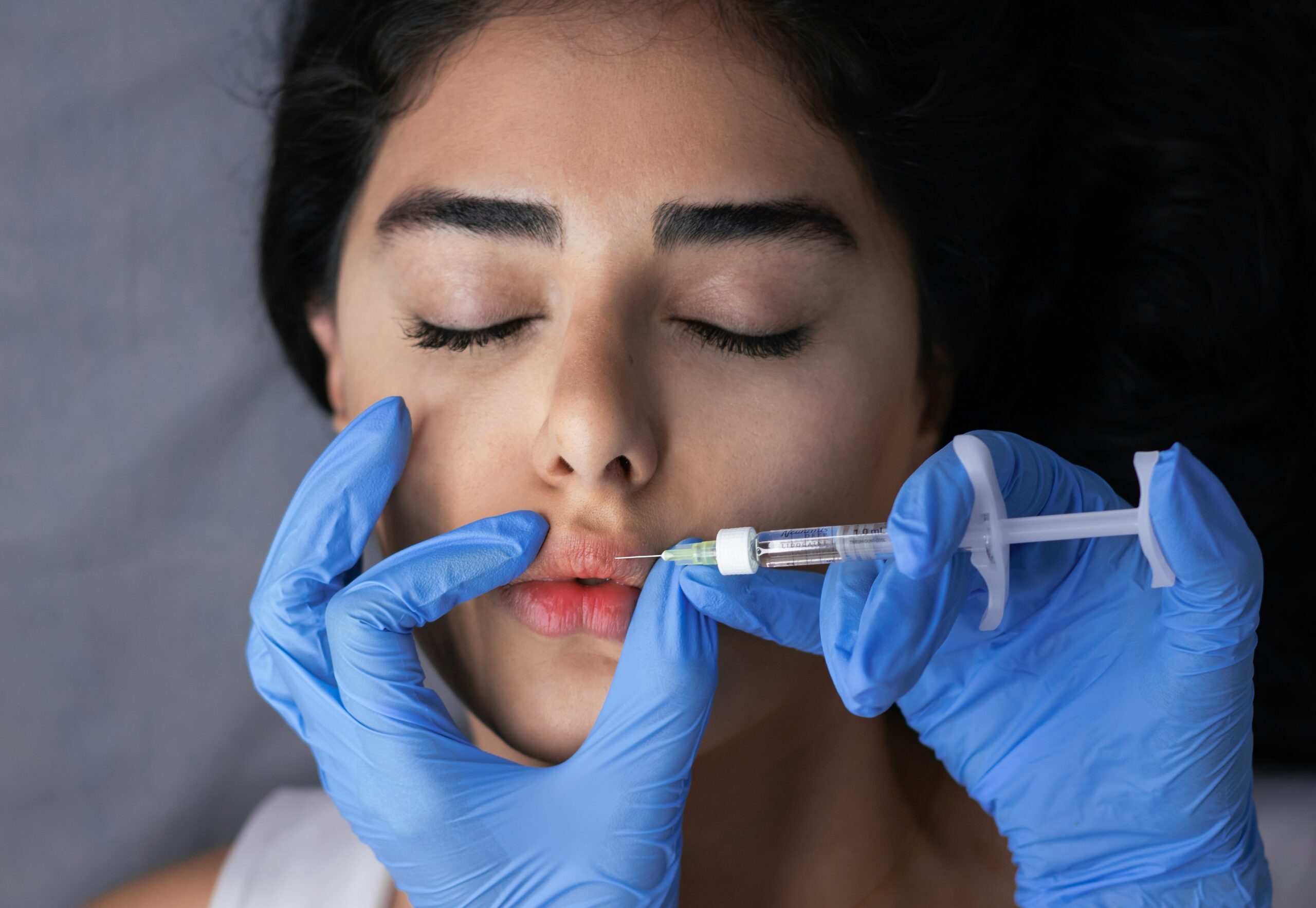 Dermal fillers Jupiter FL consultation at Genesis Dermatology